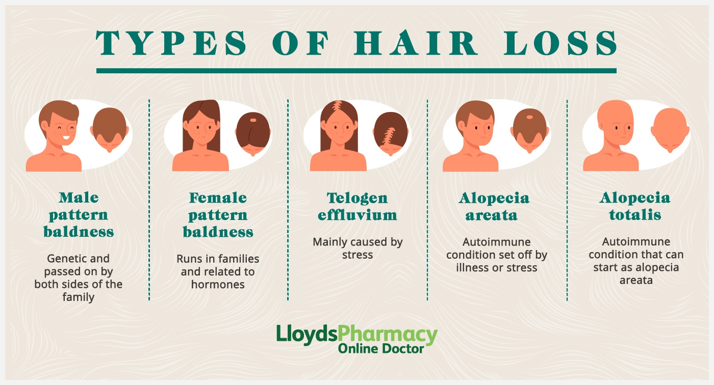 10 Causes Of Hair Loss LloydsPharmacy Online Doctor UK 10 Causes Of Hair Loss LloydsPharmacy Online Doctor UK