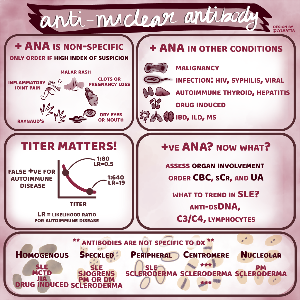 ANA Antinuclear Antibody Test 5 Pearls Segment Core IM Podcast