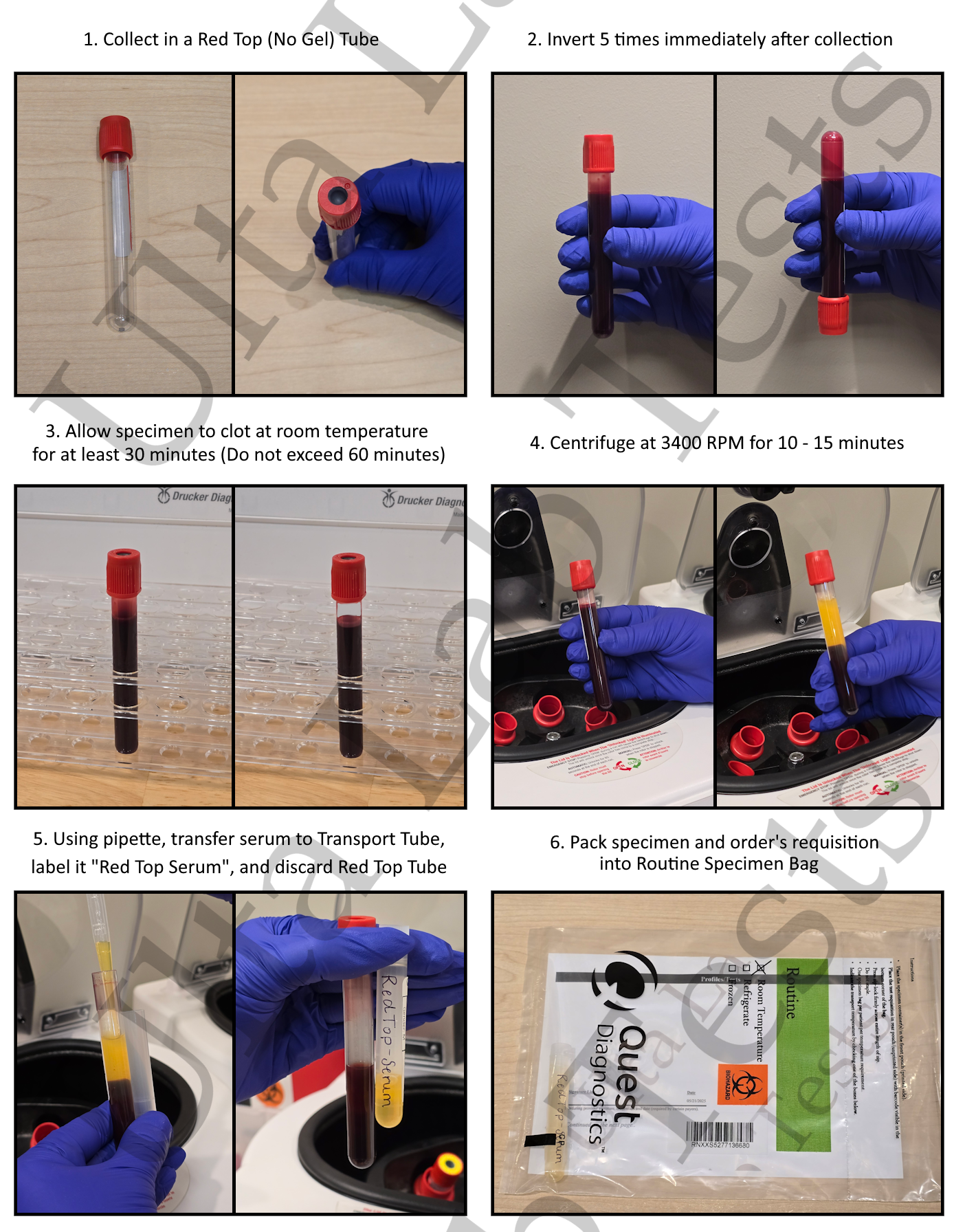 ANA Screen IFA With Reflex To Titer And Pattern Ulta Lab Tests ANA Screen IFA With Reflex To Titer And Pattern Ulta Lab Tests