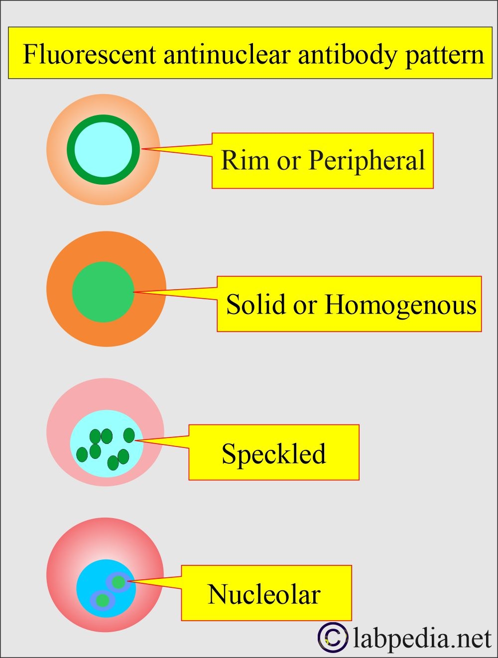 Antinuclear Factor ANF Antinuclear Antibody ANA And Its Significance Labpedia Antinuclear Factor ANF Antinuclear Antibody ANA And Its Significance Labpedia