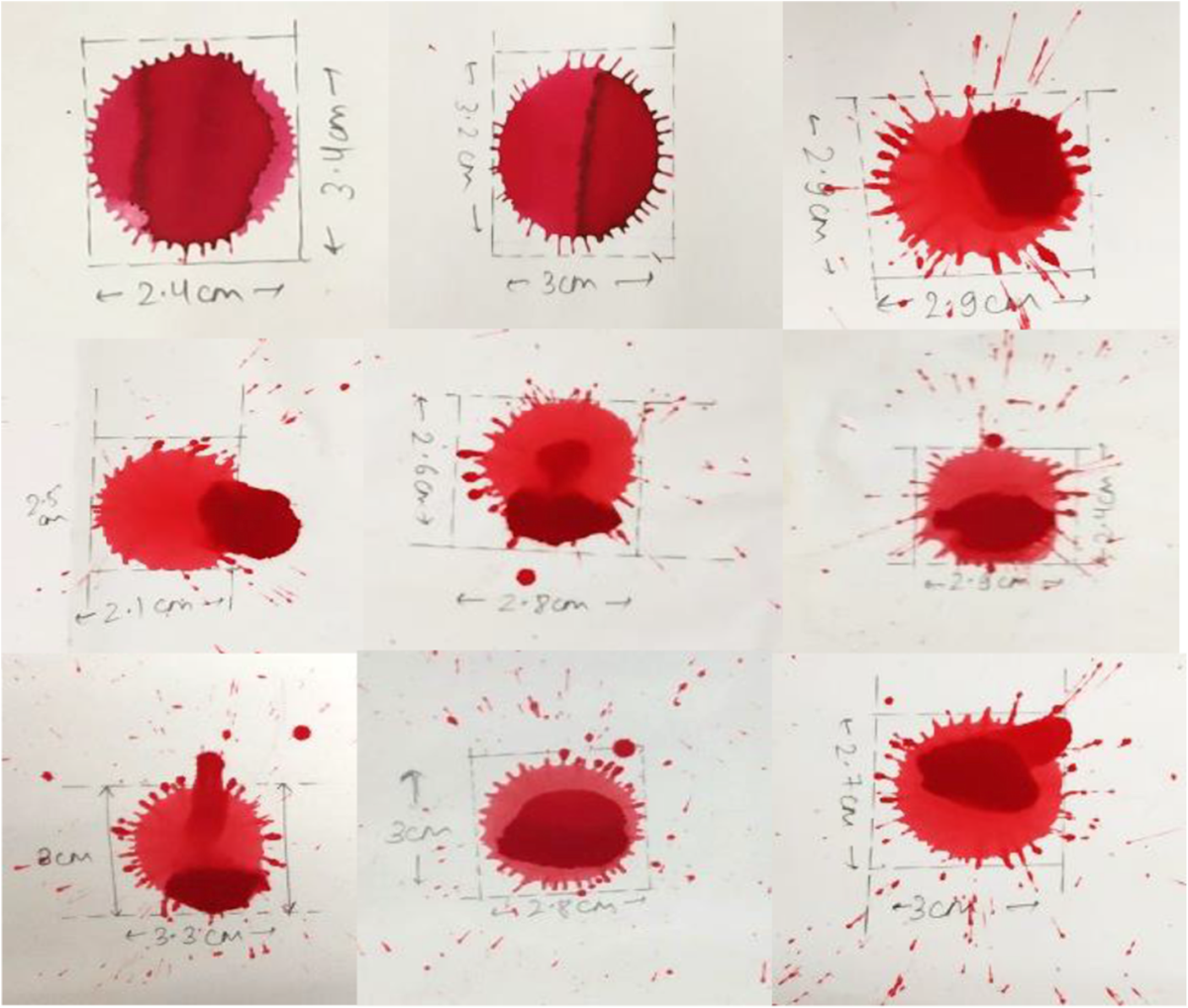 Blood Pattern Analysis a Review And New Findings Egyptian Journal Of Forensic Sciences Full Text