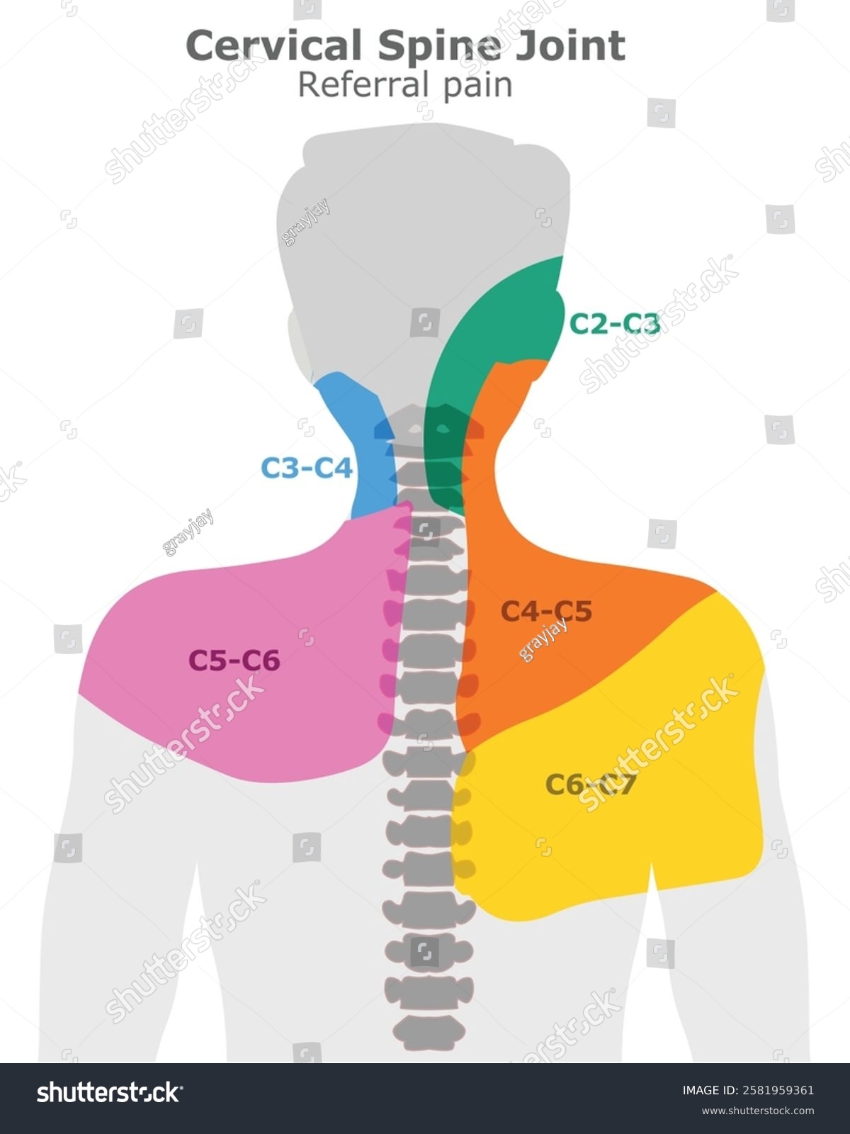 Cervical Spine Joint Referral Pain Areas Stock Vector Royalty Free 2581959361 Shutterstock