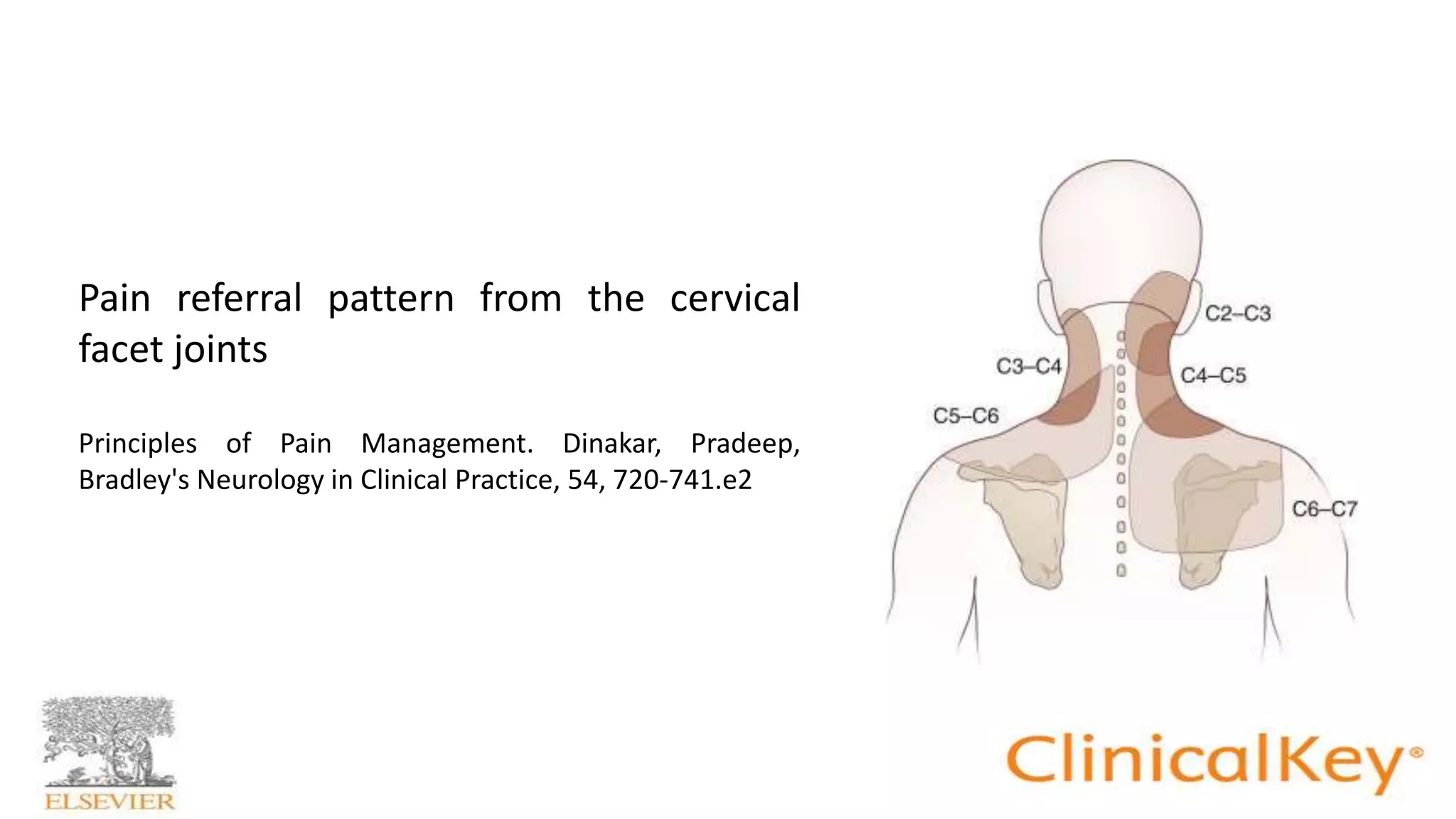 Cervicogenic Headache Following Lower Cervical RF Neurotomy PPTX