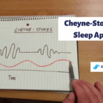 Cheyne Stokes Vs Sleep Apnea The Difference Sleep Care