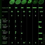 Frontiers Anti Nuclear Antibodies Patterns In Patients With Systemic Lupus Erythematosus And Their Correlation With Other Diagnostic Immunological Parameters