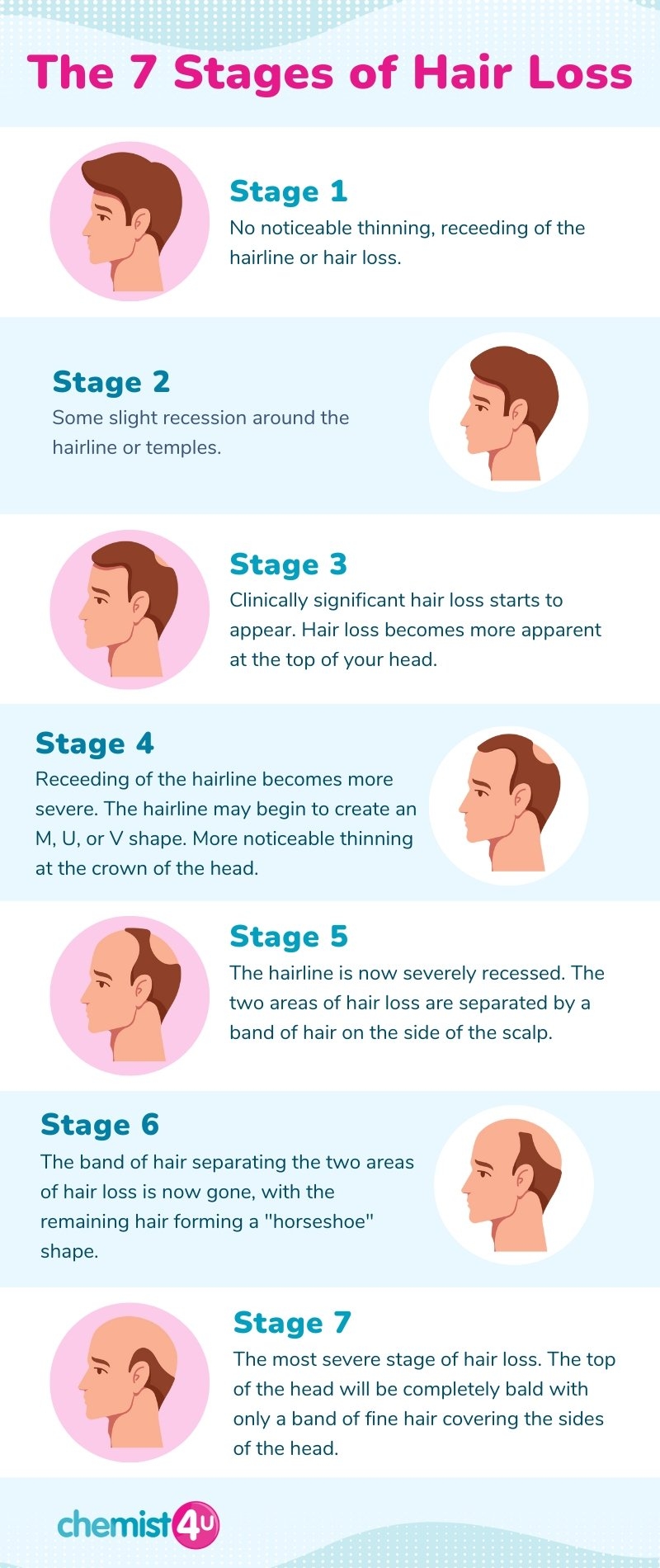 Male Pattern Baldness Treatment And Causes Guides