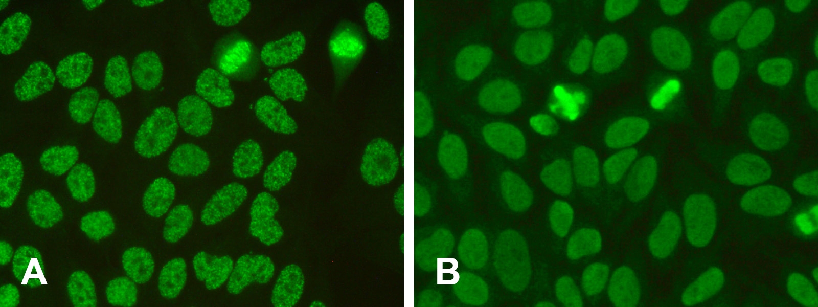 ana pattern nuclear speckled ana pattern nuclear speckled
