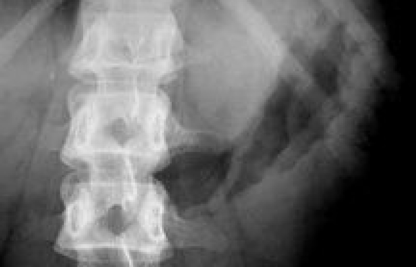Normal Vs Abnormal Gas In The Abdomen Dynamic Chiropractic Normal Vs Abnormal Gas In The Abdomen Dynamic Chiropractic