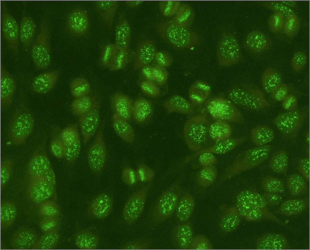 Nuclear Dot Pattern Ana Nuclear Dot Pattern Ana