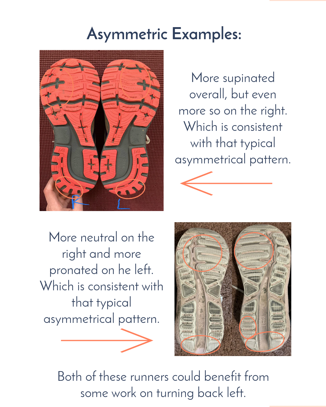 Running Shoe Wear Patterns