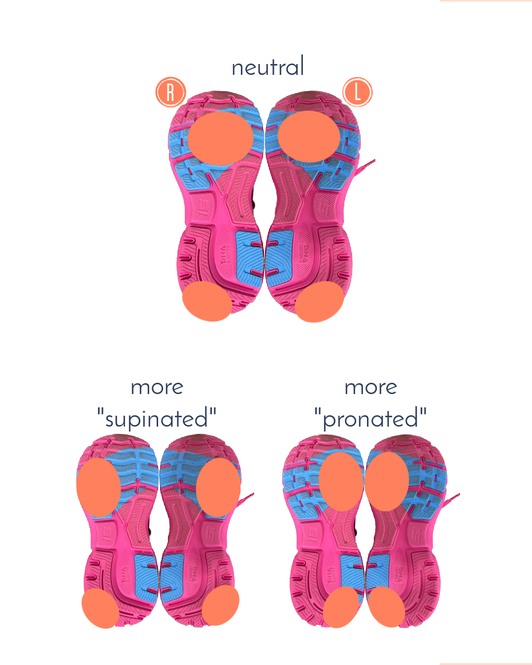 Running Shoe Wear Patterns
