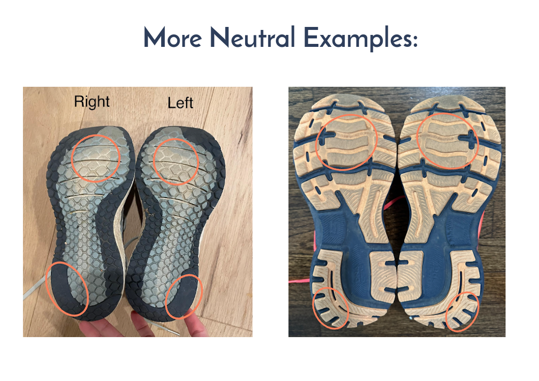 Running Shoe Wear Patterns