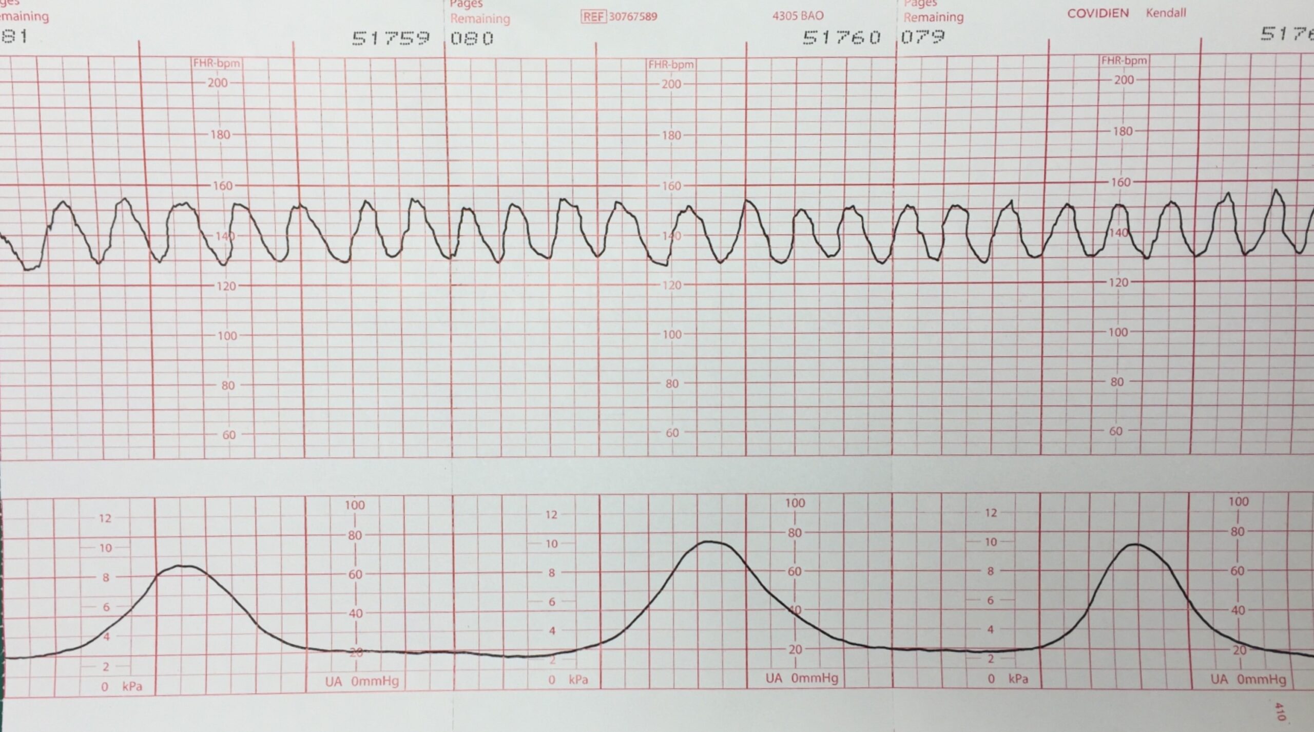 Sinusoidal Pattern Military Obstetrics Gynecology 3rd Edition