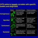 Speckled Ana Pattern Hashimoto s