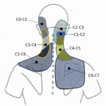 What Are Cervical Facet Injections And Why Are They Used