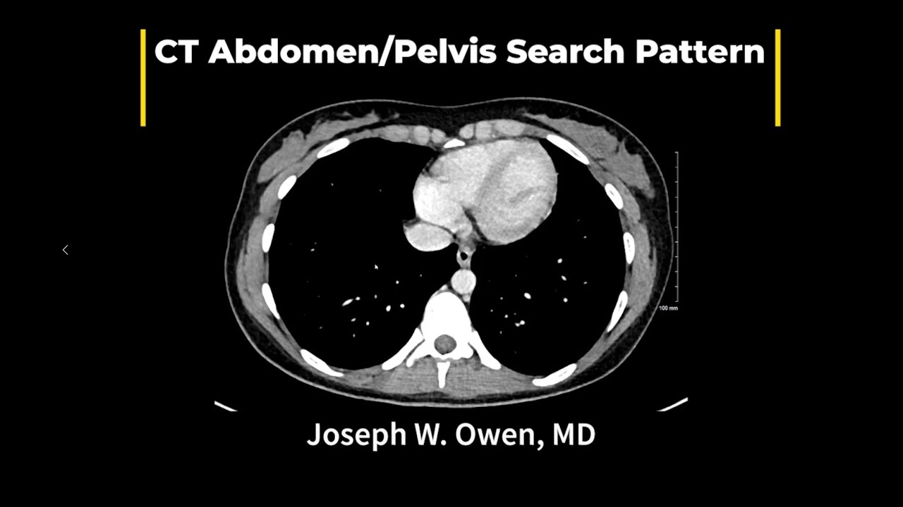 A Basic Search Pattern For Reading CT Of The Abdomen And Pelvis YouTube A Basic Search Pattern For Reading CT Of The Abdomen And Pelvis YouTube