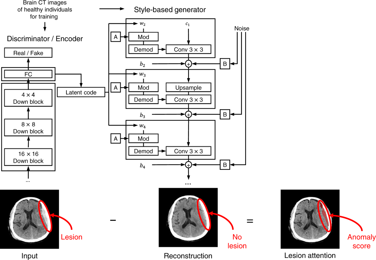 Emergency Triage Of Brain Computed Tomography Via Anomaly Detection With A Deep Generative Model Nature Communications Emergency Triage Of Brain Computed Tomography Via Anomaly Detection With A Deep Generative Model Nature Communications